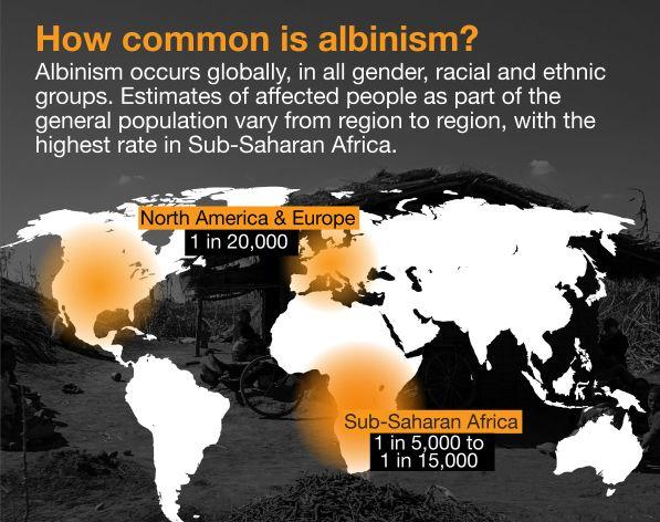 Mapa výskytu albinismu na světě.